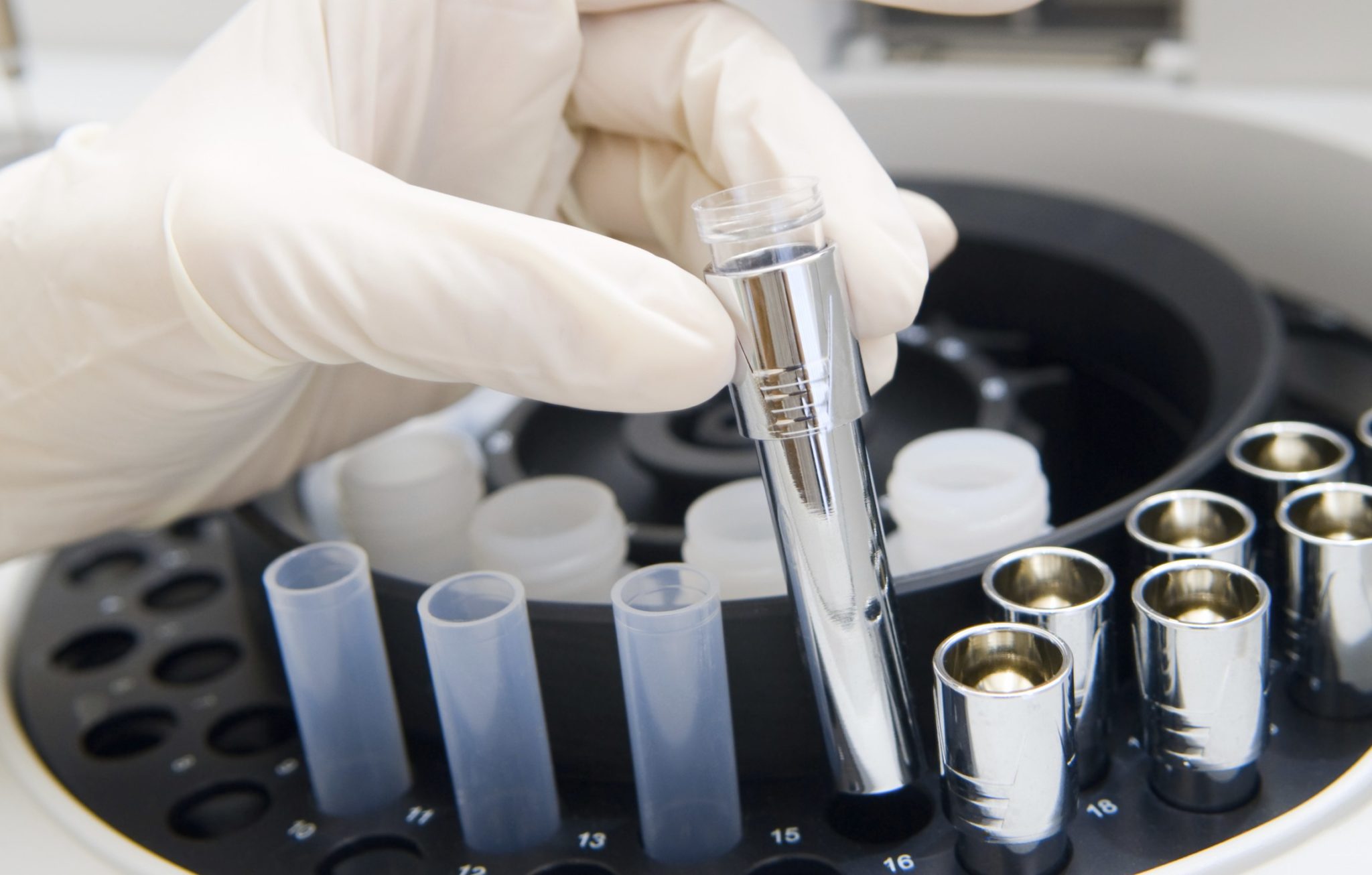 When and How to Use Confirmation Drug Testing | Averhealth